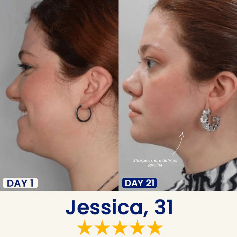 InfiniteMask® – Firmeza y Definición