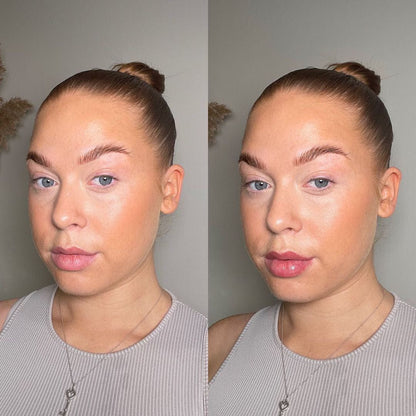 Rellenador de labios voluminizador®