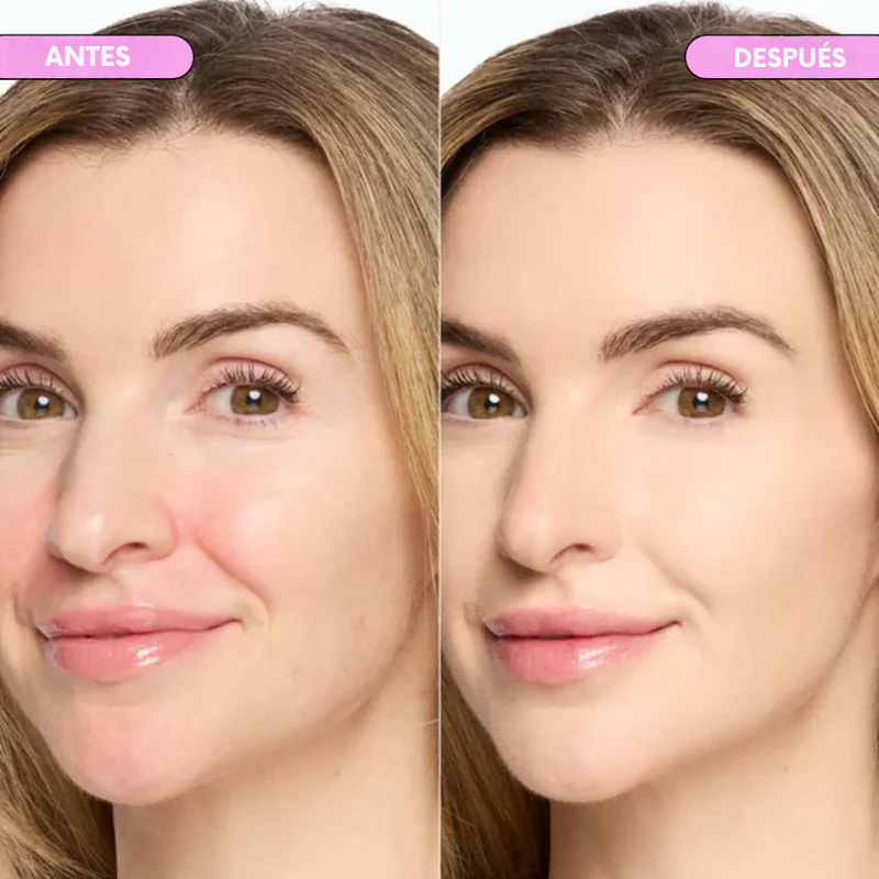 InfiniteSmooth® - Corrector de Ojeras