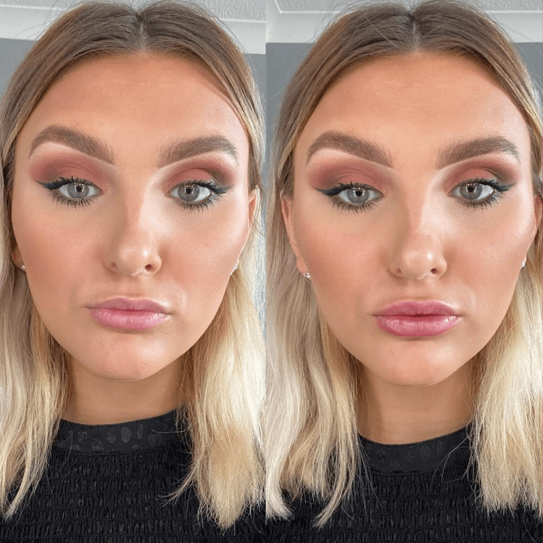 Rellenador de labios voluminizador®