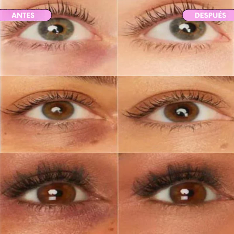 InfiniteSmooth® - Corrector de Ojeras