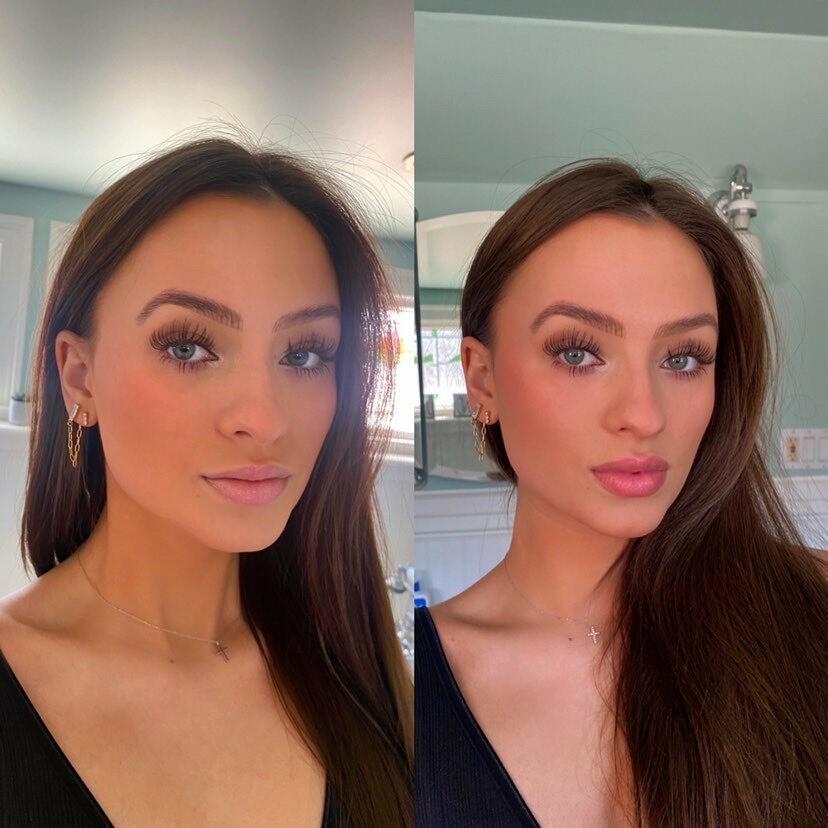 Rellenador de labios voluminizador®