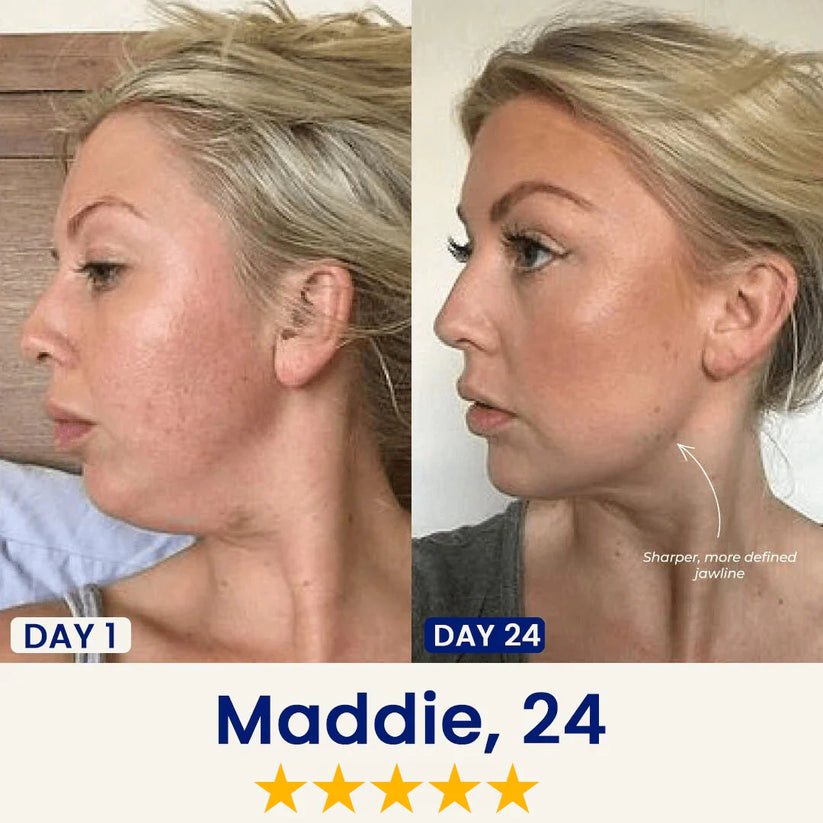 InfiniteMask® – Firmeza y Definición