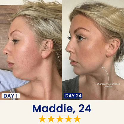 InfiniteMask® – Firmeza y Definición