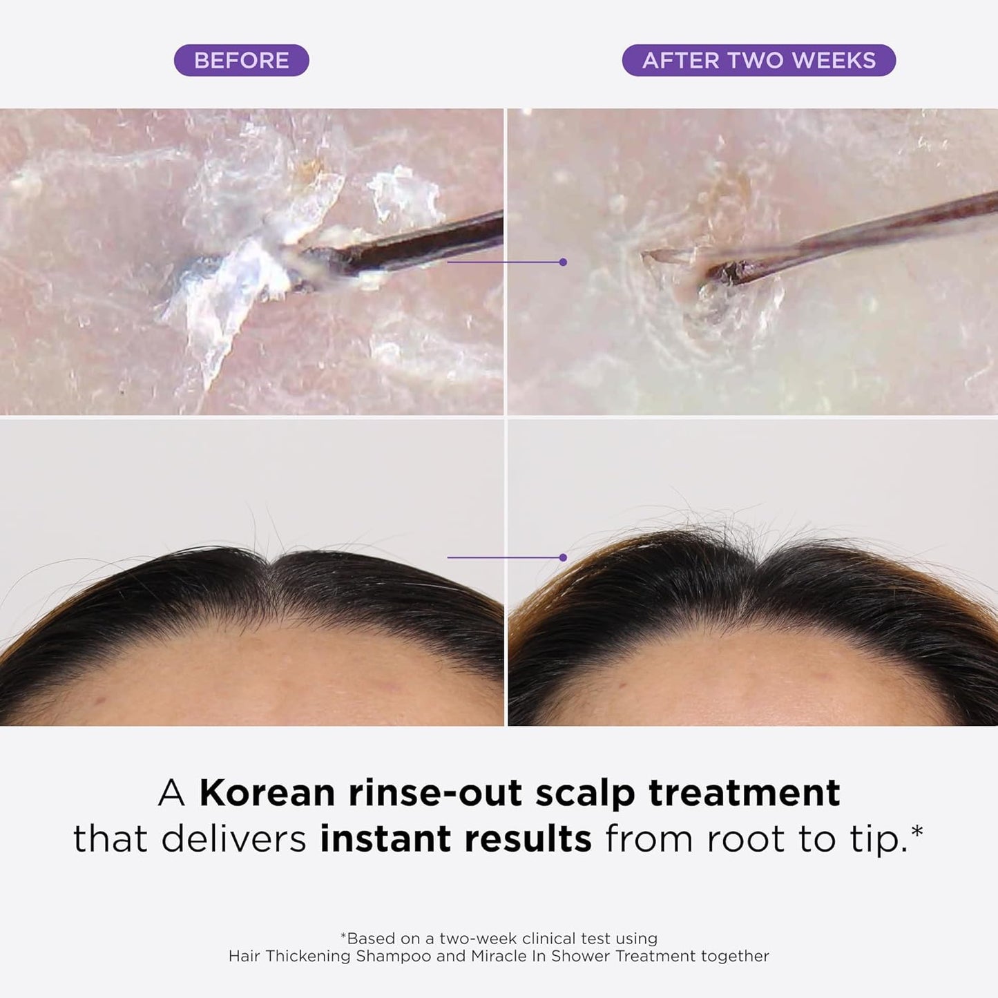 InfinitePack® - Revitalizante