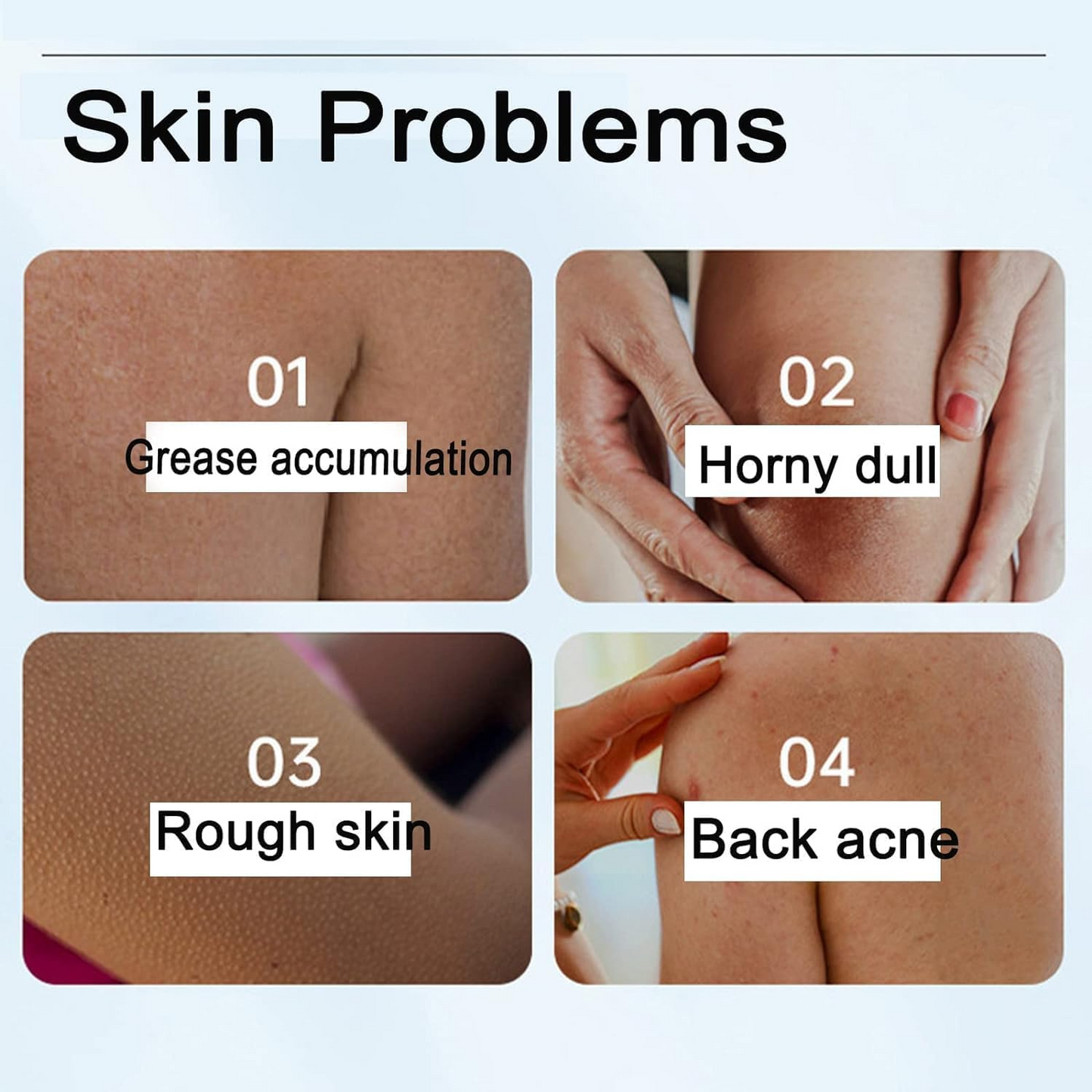 InfiniteGel® – Exfolia tus poros