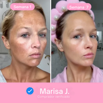 InfinitePads - Calidad para tu piel