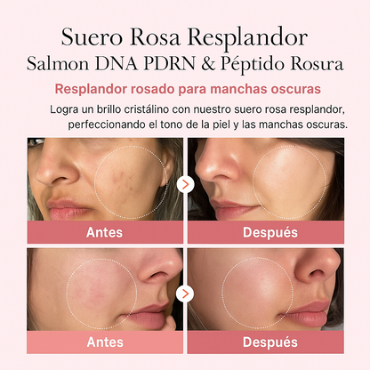 InfiniteTone® - Gel Hidratante